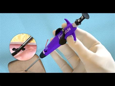 Image result for Perclose Device Tutorial