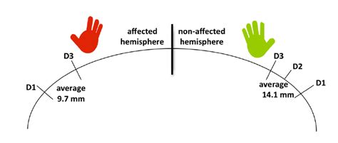 Image result for Contralateral Side