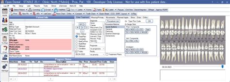 Image result for Open Dental Tutorials