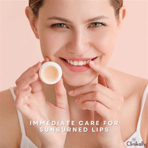 Sunburned Lips Explained: Quick Relief & Healing Tips | Clinikally