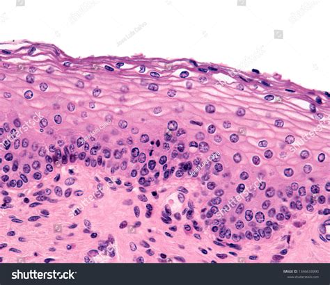 Nonkeratinized Stratified Squamous Epithelium