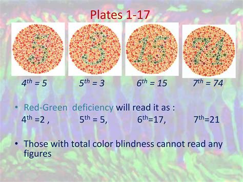 Ishihara Color Vision Testing 的图像结果