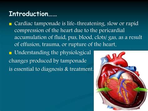 Cardiac tamponade | PPTX