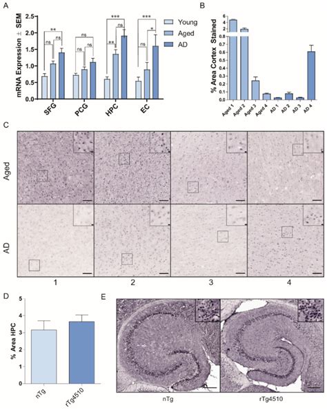 Hsp22 with an N-Terminal Domain Truncation Mediates a Reduction in Tau ...