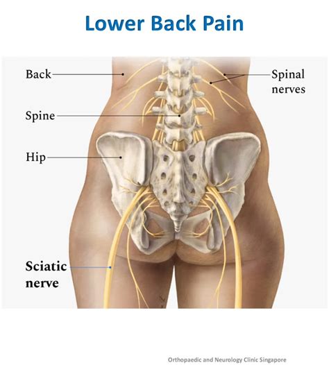 Image result for Lower Back Muscle Pain