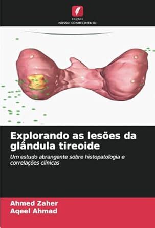 Buy Explorando as leses da glndula tireoide Book Online at Low Prices ...