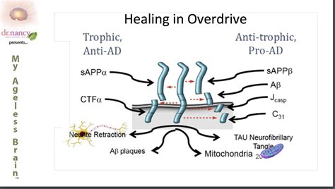 Take a Sneak Peek: My Ageless Brain with Dr. Nancy Lonsdorf! - YogaUOnline