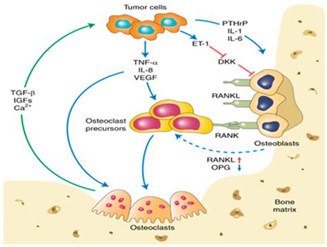 Metastatic Breast Cancer: Review of Emerging Nanotherapeutics