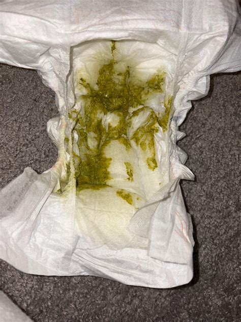Green Baby Poop Breastfed