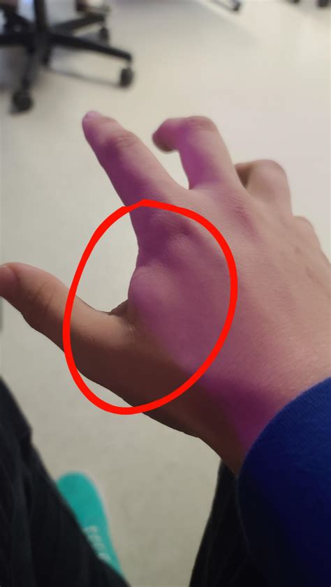 Pain Between Thumb And Index Finger Golf at Christina Sprouse blog