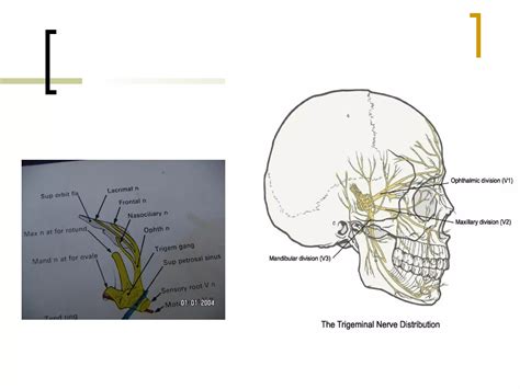 Local Anesthesia Injection Technique 的图像结果