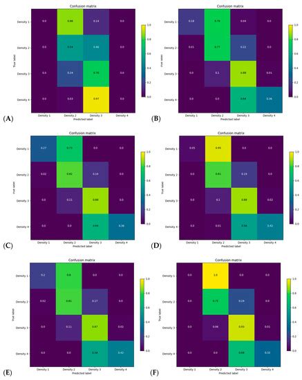 Deep Learning Models for Automated Assessment of Breast Density Using ...