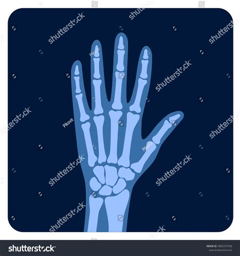 Image result for Normal Hand