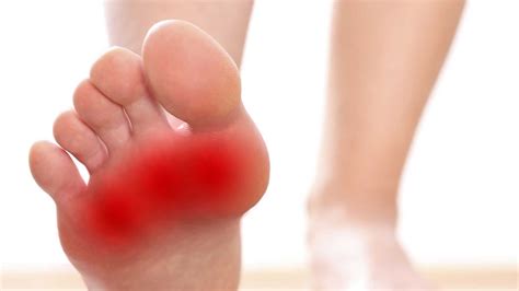 Metatarsalgia - Cyprus Association of Registered Podiatrists