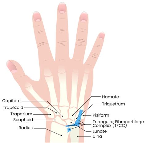 Ulna Bone Wrist Wrist Joint Replacement (Arthroplasty) Orthopedic