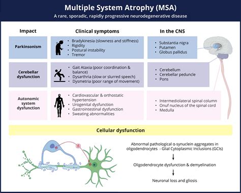 Image result for Multiple System Atrophy Progression