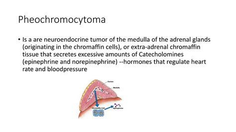 Adrenal gland diseases,Cushing syndrome,Addison disease and Pheochromocytoma | PPTX