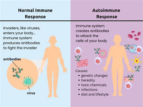 Is Ehlers Danlos Autoimmune