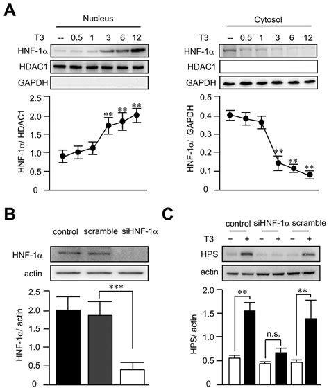 Compensatory Increase of Serum Hepassocin Protects Hyperthyroidism ...