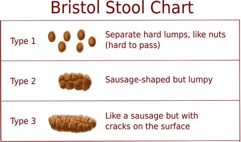 What Color Is C Diff Poop 的图像结果