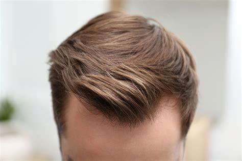 3 Inspiring widow’s Peak Hairstyles For Men