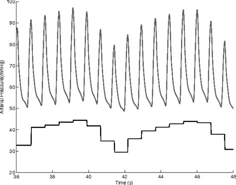 Image result for Pulse Pressure Variation Explained
