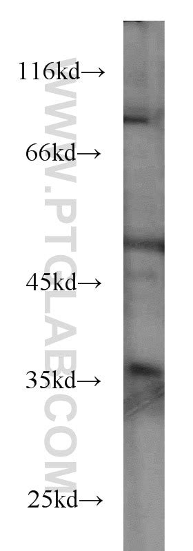 BCL2L1 antibody (66020-1-Ig) | Proteintech