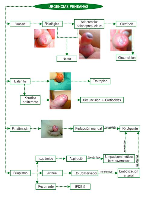 Balanitis En Niños: Causas, Síntomas Y Tratamiento | Doctor Online