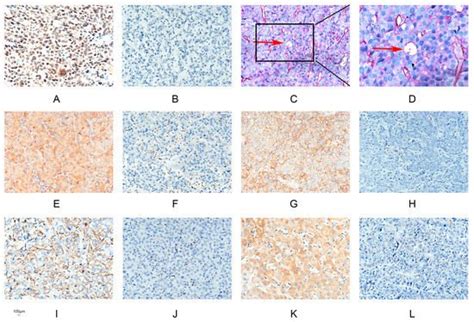 Correction: Cao, Z., et al. The Expression and Functional Significance ...