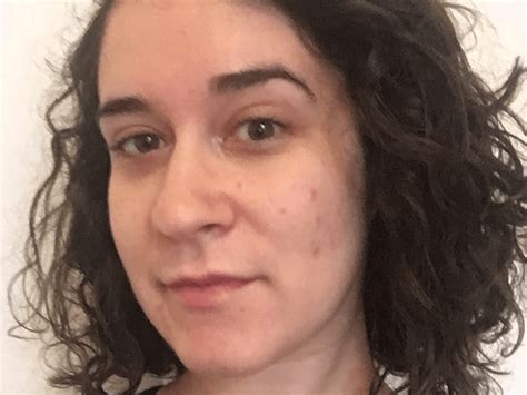 Image result for Exploding Zits 2019