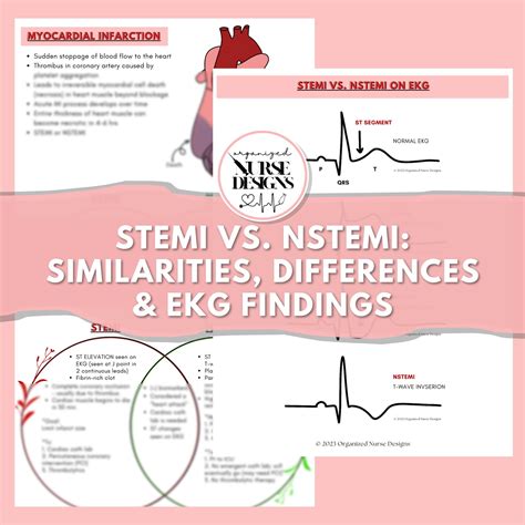 Stemi vs nstemi – Artofit