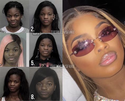 Jt Face Before Surgery