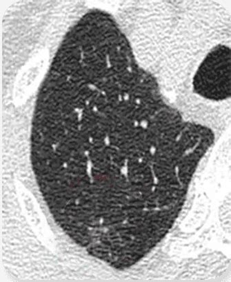 Nura Ai Health Screening Center Hyderabad