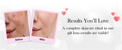 Buy Globus Naturals Valentine Special Revival Rice Ceramide Skincare ...