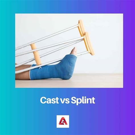 Cast vs Splint: Difference and Comparison