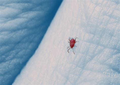 Chiggers Symptoms And Treatment Pin On Bugs You