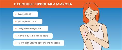 Лечение грибка кожи: как избавиться и чем лечить грибок кожи?