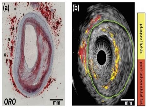 Advanced Ultrasound and Photoacoustic Imaging in Cardiology