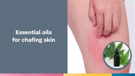 Essential Oils for Chafing Skin: Effective or Myth? – tryverima.com
