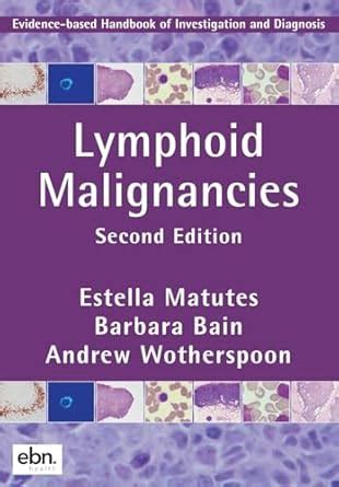 Buy Lymphoid Malignancies: Evidence-based Handbook of Investigation and ...