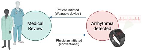 Wearable Devices for Arrhythmia Detection: Advancements and Clinical ...
