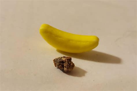 Kidney Stones In Men