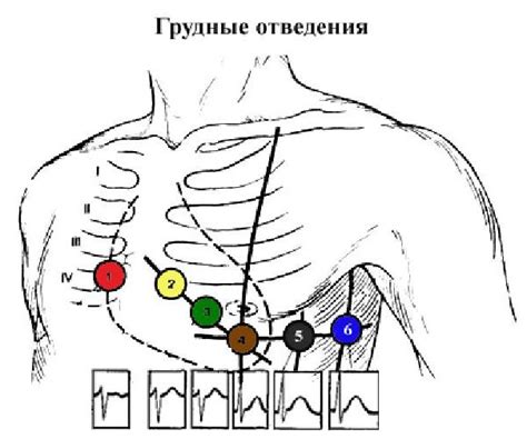 Цвета экг электродов поговорка