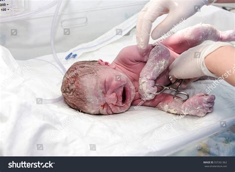 After Baby Birth