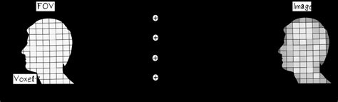 Frequency vs Phase Encoding 的图像结果