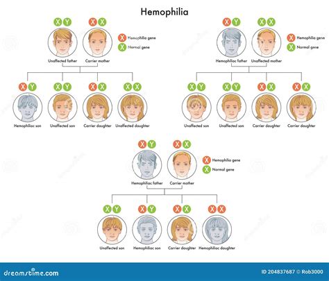Hemophilia Gene Inheritance Stock Vector - Illustration of inheritance ...