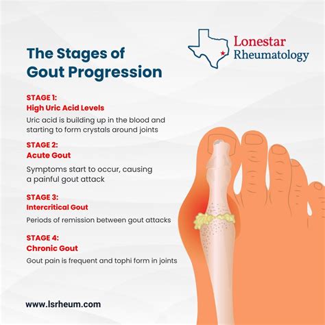 #rheumatology #arthritis #rheumatoidarthritis #rheumatologist #lupus #autoimmunedisease #like # ...