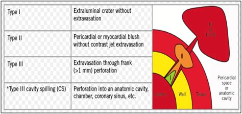 Image result for Graphical Abstract Examples of a Process