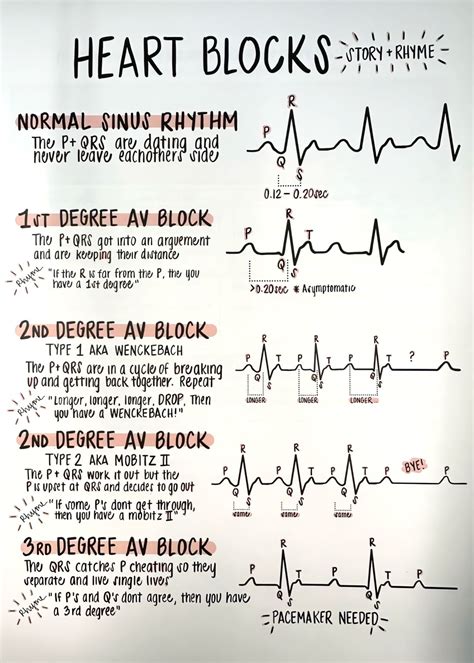 𝗛𝗘𝗔𝗥𝗧 𝗕𝗟𝗢𝗖𝗞𝗦 𝗠𝗔𝗗𝗘 𝗦𝗜𝗠𝗣𝗟𝗘 This image provides a visual explanation of ...