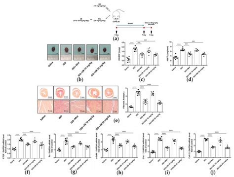 Zanubrutinib Ameliorates Cardiac Fibrosis and Inflammation Induced by ...
